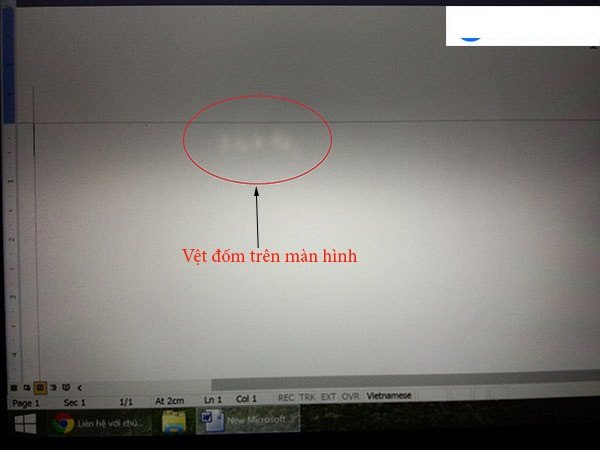 Các vết ố hoặc đốm mờ trên màn hình laptop MSI GF63