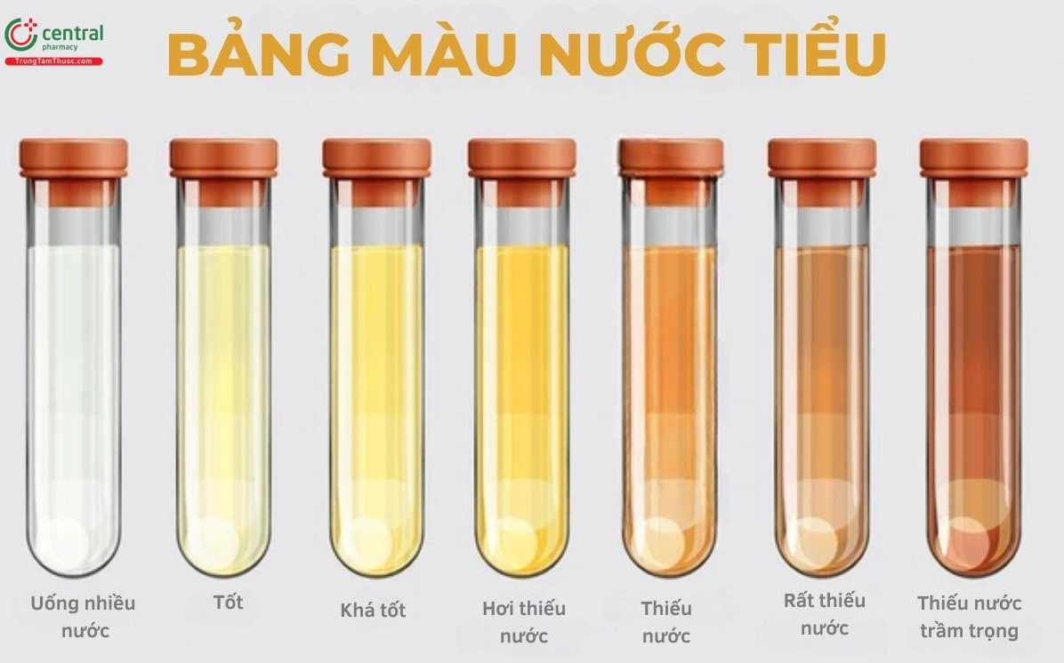 Nước tiểu như thế nào là bình thường? Dấu hiệu nhận biết Bảng màu nước tiểu và các cảnh báo
