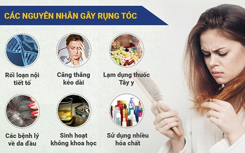 Tại Sao Tóc Rụng Nhiều? Khám Phá Lý Do Chuyên Sâu & Giải Pháp 2026 Người đàn ông bị rụng tóc do stress